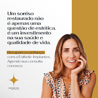 ESTHETIC IMPLANTES ODONTOLOGIA