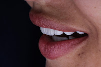 ESTHETIC IMPLANTES ODONTOLOGIA
