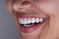 ESTHETIC IMPLANTES ODONTOLOGIA