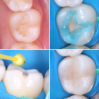 Dentista em Campo Grande MS Inovare Odontologia