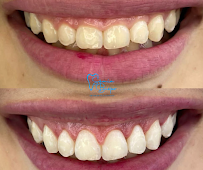 Bispo Clinic | Dentista em Teresina - PI