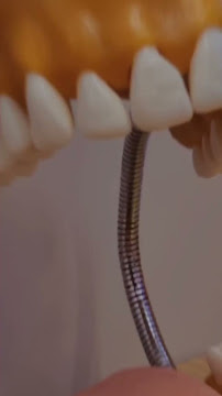 Oralfy Teresina - Implantes • Facetas • Invisalign • Próteses