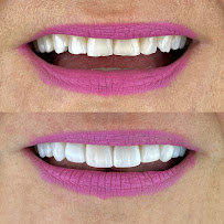 Oralfy Teresina - Implantes • Facetas • Invisalign • Próteses