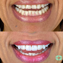 Oralfy Teresina - Implantes • Facetas • Invisalign • Próteses