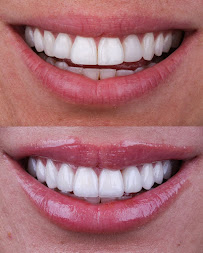 Oralfy Teresina - Implantes • Facetas • Invisalign • Próteses