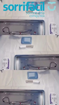 Sorrifácil - Teresina Centro Implantes, Prótese Protocolo, Reabilitação Oral e Lentes de Contato
