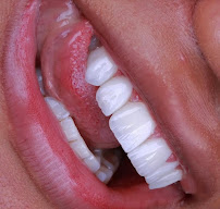 DENTISTA 24H TERESINA | URGÊNCIAS E ESTÉTICA | BWR ODONTOLOGIA