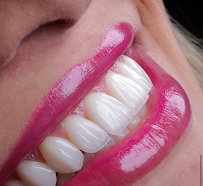 DENTISTA 24H TERESINA | URGÊNCIAS E ESTÉTICA | BWR ODONTOLOGIA
