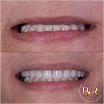 DENTISTA 24H TERESINA | URGÊNCIAS E ESTÉTICA | BWR ODONTOLOGIA