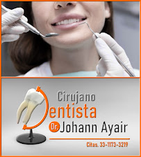 Dentista en Guadalajara Dr.Johann Ayair (Consultorio Dental en Guadalajara)