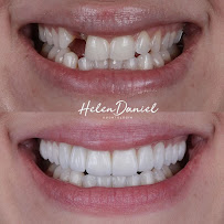 Helen Daniel Odontologia
