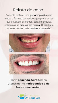 Clínica Odontológica Dr. Isaac Luís | Teresina - PI