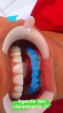 Dentista Teresina Dr. Denival Sampaio | Consulta odontológica & Emergencia odontologica