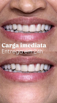 Sorrifácil Jóquei (Implantes, Prótese Protocolo, Reabilitação Oral e Lentes de Contato)