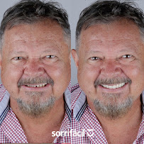 Sorrifácil Jóquei (Implantes, Prótese Protocolo, Reabilitação Oral e Lentes de Contato)