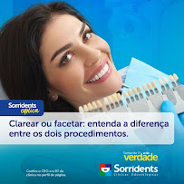Sorridents Jockey: Dentista, Clínica Odontológica, Clareamento em Teresina