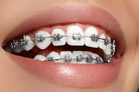 Dr. Sorriso | Dentista em Teresina | Urgências odontológicas