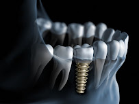 Dr. Sorriso | Dentista em Teresina | Urgências odontológicas