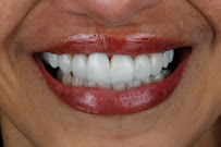 Dr. Sorriso | Dentista em Teresina | Urgências odontológicas