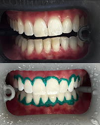 Dra. Larissa Chaves - Dentista e Tratamento de Canal em João Pessoa