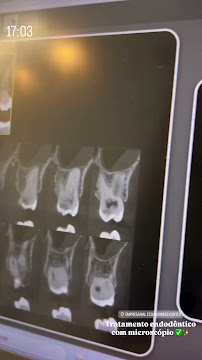 Dra. Larissa Chaves - Dentista e Tratamento de Canal em João Pessoa