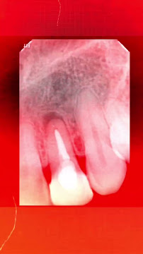 Dra. Larissa Chaves - Dentista e Tratamento de Canal em João Pessoa
