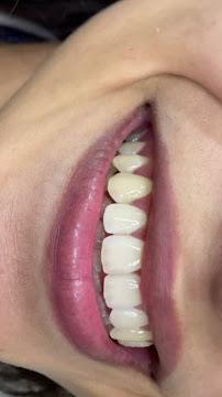 OdontoCompany Geisel - Clínica Odontológica - Próteses - Implantes - Ortodontia - Dentistas