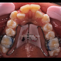 Consultorio dental Mejorada