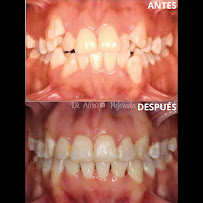 Consultorio dental Mejorada