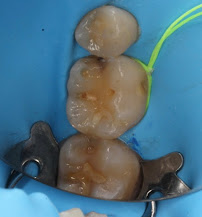 Consultorio dental Mejorada