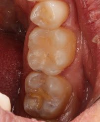 Consultorio dental Mejorada