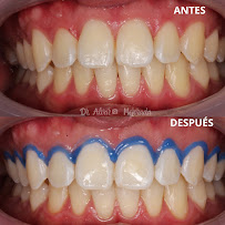 Consultorio dental Mejorada
