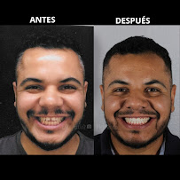 Consultorio dental Mejorada
