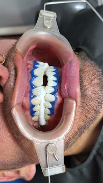 Consultorio dental Mejorada