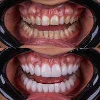 Clínica Viotto João Pessoa Dental Clinic in João Pessoa