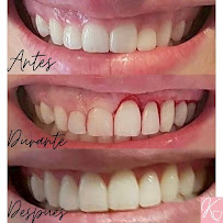 Dra. Kenia Barrera Periodoncia e Implantología