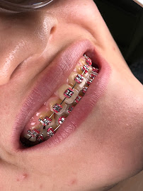 Hiperdental