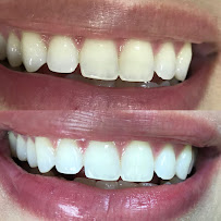 Prof. Rafaella Bastos Leite - Dentista em João Pessoa