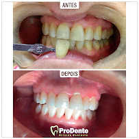 Dentista | Implante Dentário | ProDente Clínica Dentaria | Jardim Caramuru | Dourados - MS