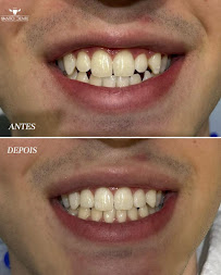 Santo Dente Odontologia - Dentista em Dourados | Especialista em Implante Dentário