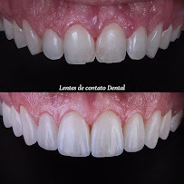 Santo Dente Odontologia - Dentista em Dourados | Especialista em Implante Dentário