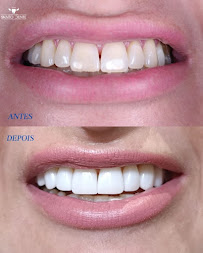 Santo Dente Odontologia - Dentista em Dourados | Especialista em Implante Dentário