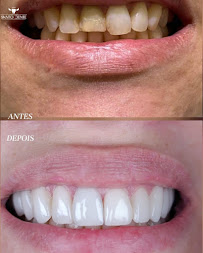 Santo Dente Odontologia - Dentista em Dourados | Especialista em Implante Dentário