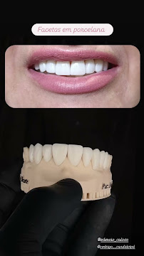 Santo Dente Odontologia - Dentista em Dourados | Especialista em Implante Dentário