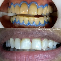 Bertalia Odontologia e Estética Facial