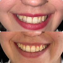 Dra. Ana Paula Mesquita Marques - Invisalign Doctor