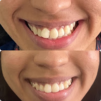 Dra. Ana Paula Mesquita Marques - Invisalign Doctor