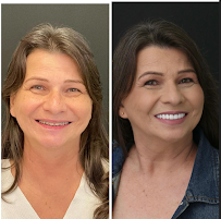Le Blue Odontologia - Dentista Passo Fundo