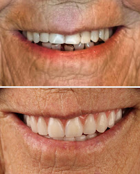 Oral Unic Implantes Passo Fundo Dental Clinic in Passo Fundo, Brazil