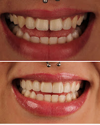 Oral Unic Implantes Passo Fundo